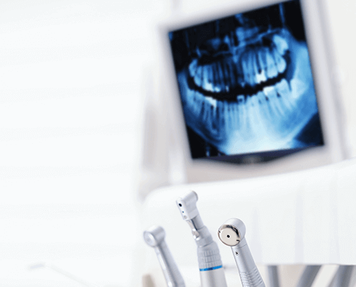 Close-up of dental handpieces in a modern dental office, with a digital panoramic X-ray of a patient's teeth displayed on a screen in the background.